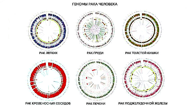 Ученые научились определять точную причину раковой опухоли по ее ДНК
