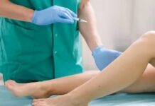 Современные методы лечения варикоза