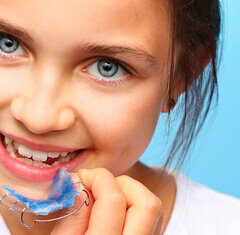 Особенности исправления прикуса у детей