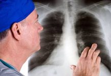 Офев при заболевании легких