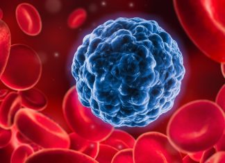 Рак крови: какой прогноз?