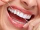 Как ухаживать за зубами с винирами?