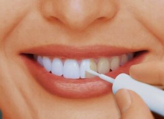 Как без вреда отбелить зубы?