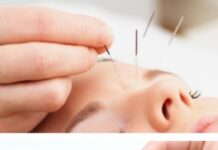 Что такое иглорефлексотерапия?