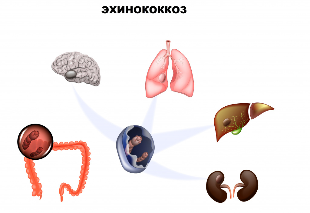 Поражаемые органы человека