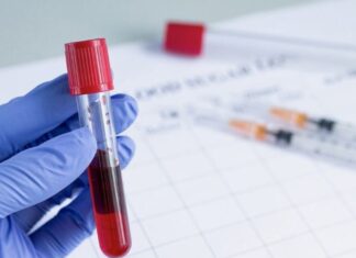 Красная волчанка: симптомы и изменения в анализе крови