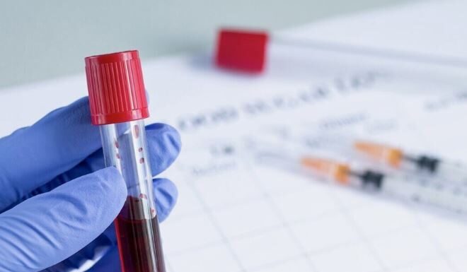 Красная волчанка: симптомы и изменения в анализе крови