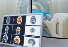 Второй взгляд на ПЭТ-КТ: почему важна экспертная повторная оценка