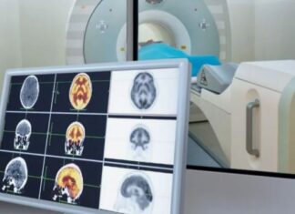 Второй взгляд на ПЭТ-КТ: почему важна экспертная повторная оценка