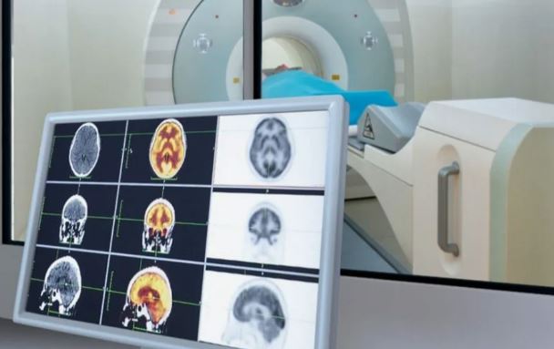 Второй взгляд на ПЭТ-КТ: почему важна экспертная повторная оценка