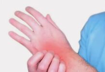 Псориатический артрит: симптомы, диагностика и лечение