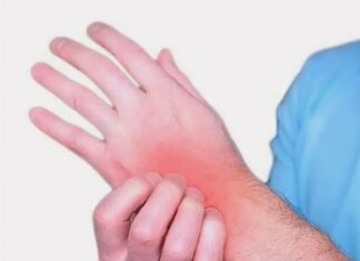 Псориатический артрит: симптомы, диагностика и лечение