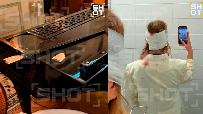 Девушке проломило голову роялем в элитном ресторане в ГУМе, ей дали скидку в качестве платы за кровь