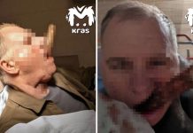 Черенок лопаты пронзил шею жителю Красноярска и вышел через рот при падении с крыши