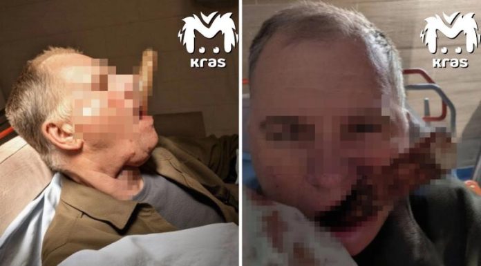 Черенок лопаты пронзил шею жителю Красноярска и вышел через рот при падении с крыши