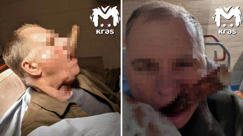 Черенок лопаты пронзил шею жителю Красноярска и вышел через рот при падении с крыши